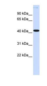 MSY2 / YBX2 Antibody - YBX2 antibody Western blot of Fetal Lung lysate. This image was taken for the unconjugated form of this product. Other forms have not been tested.