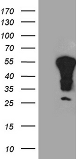 MSY2 / YBX2 Antibody - HEK293T cells were transfected with the pCMV6-ENTRY control. (Left lane) or pCMV6-ENTRY YBX2. (Right lane) cDNA for 48 hrs and lysed