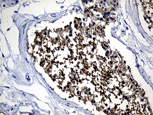MSY2 / YBX2 Antibody - Immunohistochemical staining of paraffin-embedded Human testicle tissue within the normal limits using anti-YBX2 mouse monoclonal antibody. (Heat-induced epitope retrieval by 1mM EDTA in 10mM Tris buffer. (pH8.5) at 120°C for 3 min. (1:150)
