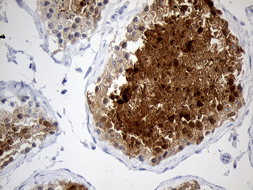 MSY2 / YBX2 Antibody - Immunohistochemical staining of paraffin-embedded Human testicle tissue within the normal limits using anti-YBX2 mouse monoclonal antibody. (Heat-induced epitope retrieval by 1mM EDTA in 10mM Tris buffer. (pH8.5) at 120°C for 3 min. (1:500)