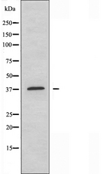MSY2 / YBX2 Antibody - Western blot analysis of extracts of COLO205 cells using YBOX2 antibody.