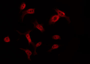 MSY2 / YBX2 Antibody - Staining COLO205 cells by IF/ICC. The samples were fixed with PFA and permeabilized in 0.1% Triton X-100, then blocked in 10% serum for 45 min at 25°C. The primary antibody was diluted at 1:200 and incubated with the sample for 1 hour at 37°C. An Alexa Fluor 594 conjugated goat anti-rabbit IgG (H+L) Ab, diluted at 1/600, was used as the secondary antibody.