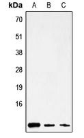 MT-ATP8 Antibody - Western blot analysis of ATP8 expression in HepG2 (A); mouse brain (B); rat stomach (C) whole cell lysates.