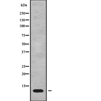 MT-ATP8 Antibody - Western blot analysis of MT-ATP8 using Jurkat whole cells lysates