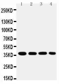 MT-CO1 / COX1 Antibody - MTCO1 antibody Western blot. Lane 1: SMMC Cell Lysate. Lane 2: MCF-7 Cell Lysate. Lane 3: RAJI Cell Lysate. Lane 4: SW620 Cell Lysate.