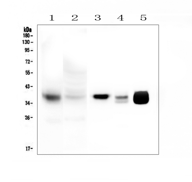 MT-CO1 / COX1 Antibody - Western blot analysis of MTCO1 using anti-MTCO1 antibody. Electrophoresis was performed on a 5-20% SDS-PAGE gel at 70V (Stacking gel) / 90V (Resolving gel) for 2-3 hours. The samples were loaded under reducing conditions. Lane 1: human HeLa mitochondria lysates at 20ug, Lane 2: human HeLa whole cell lysates at 20ug, Lane 3: human Caco-2 whole cell lysates at 50ug, Lane 4: rat heart tissue lysates at 50ug. Lane 5: mouse heart tissue lysates at 50ug. After Electrophoresis, proteins were transferred to a Nitrocellulose membrane at 150mA for 60 minutes. Blocked the membrane with 5% Non-fat Milk in TBS for 1.5 hour at RT. The membrane was incubated with rabbit anti-MTCO1 antigen affinity purified polyclonal antibody at 0.5 µg/mL overnight at 4°C, then washed with TBS-0.1% Tween 3 times with 5 minutes each and probed with a goat anti-rabbit IgG-HRP secondary antibody at a dilution of 1:10000 for 1.5 hour at RT. The signal is developed using an Enhanced Chemiluminescent detection (ECL) kit with Tanon 5200 system. A specific band was detected for MTCO1 at approximately 37KD. The expected band size for MTCO1 is at 57KD.