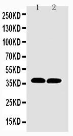 MT-CO1 / COX1 Antibody - MTCO1 antibody Western blot. Lane 1: Rat Heart Tissue Lysate. Lane 2: Mouse Heart Tissue Lysate.