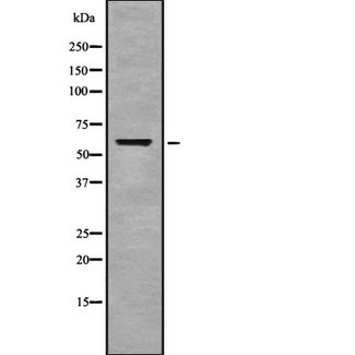 MT-CO1 / COX1 Antibody - Western blot analysis of Cytochrome c Oxidase 1 using COLO205 whole cells lysates
