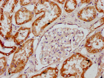 MT-CO2 Antibody - Immunohistochemistry Dilution at 1:400 and staining in paraffin-embedded human kidney tissue performed on a Leica BondTM system. After dewaxing and hydration, antigen retrieval was mediated by high pressure in a citrate buffer (pH 6.0). Section was blocked with 10% normal Goat serum 30min at RT. Then primary antibody (1% BSA) was incubated at 4°C overnight. The primary is detected by a biotinylated Secondary antibody and visualized using an HRP conjugated SP system.