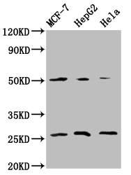 MT-CO2 Antibody - Western Blot Positive WB detected in: MCF-7 whole cell lysate, HepG2 whole cell lysate, Hela whole cell lysate All lanes: MT-CO2 antibody at 5.9µg/ml Secondary Goat polyclonal to rabbit IgG at 1/50000 dilution Predicted band size: 26 kDa Observed band size: 26 kDa