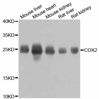 MT-CO2 Antibody - Western blot analysis of extracts of various cell lines, using MT-CO2 antibody at 1:800 dilution. The secondary antibody used was an HRP Goat Anti-Rabbit IgG (H+L) at 1:10000 dilution. Lysates were loaded 25ug per lane and 3% nonfat dry milk in TBST was used for blocking. An ECL Kit was used for detection and the exposure time was 15s.