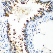 MT-CO2 Antibody - Immunohistochemistry of paraffin-embedded rat lung using MT-CO2 antibody at dilution of 1:100 (40x lens).