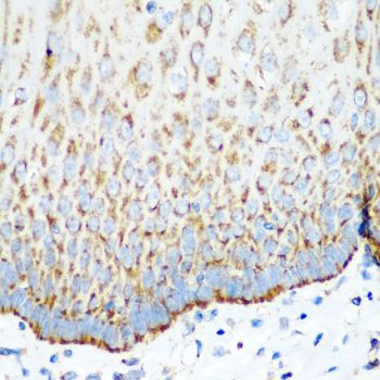 MT-CO2 Antibody - Immunohistochemistry of paraffin-embedded human esophagus using MT-CO2 antibody at dilution of 1:100 (40x lens).