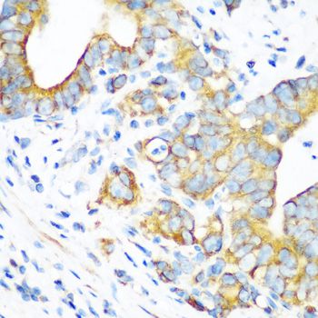 MT-CO2 Antibody - Immunohistochemistry of paraffin-embedded human stomach using MT-CO2 antibody at dilution of 1:100 (40x lens).