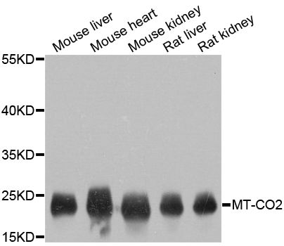 MT-CO2 Antibody - Western blot analysis of extracts of various cell lines, using MT-CO2 antibody at 1:800 dilution. The secondary antibody used was an HRP Goat Anti-Rabbit IgG (H+L) at 1:10000 dilution. Lysates were loaded 25ug per lane and 3% nonfat dry milk in TBST was used for blocking. An ECL Kit was used for detection and the exposure time was 1s.