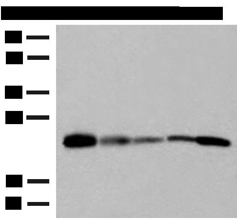 MT-CO2 Antibody - Western blot analysis of 293T 231 HUVEC Hela and A549 cell lysates  using MT-CO2 Polyclonal Antibody at dilution of 1:400