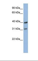MT-CO3 / COX3 / COXIII Antibody - 721_B cell lysate. Antibody concentration: 1.0 ug/ml. Gel concentration: 12%.  This image was taken for the unconjugated form of this product. Other forms have not been tested.