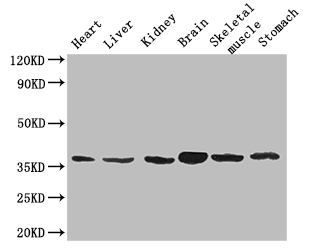 MT-ND1 Antibody - Positive WB detected in:Mouse heart tissue,Mouse liver tissue,Mouse kidney tissue,Mouse brain tissue,Mouse skeletal muscle tissue,Mouse stomach tissue;All lanes: MTND1 antibody at 3ug/ml;Secondary;Goat polyclonal to rabbit IgG at 1/50000 dilution;Predicted band size: 36 kDa;Observed band size: 36 kDa;
