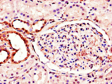MT-ND1 Antibody - Immunohistochemistry of paraffin-embedded human kidney tissue using MT-ND1 Antibody at dilution of 1:100