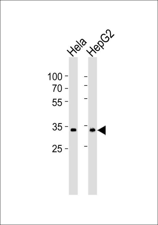 MT-ND1 Antibody - Western blot of lysates from HeLa, HepG2 cell line (from left to right) with MT-ND1 Antibody. Antibody was diluted at 1:1000 at each lane. A goat anti-rabbit IgG H&L (HRP) at 1:5000 dilution was used as the secondary antibody. Lysates at 35 ug per lane.