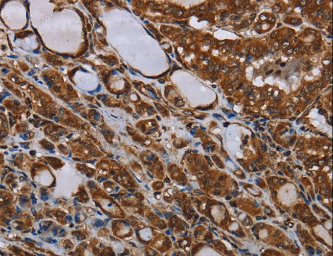 MT-ND1 Antibody - Immunohistochemistry of paraffin-embedded Human brain using MT-ND1 Polyclonal Antibody at dilution of 1:30.
