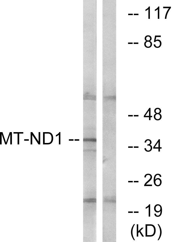 MT-ND1 Antibody - Western blot analysis of extracts from Jurkat cells, using MT-ND1 antibody.