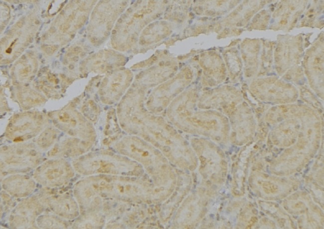 MT-ND4L Antibody - 1:100 staining mouse kidney tissue by IHC-P. The sample was formaldehyde fixed and a heat mediated antigen retrieval step in citrate buffer was performed. The sample was then blocked and incubated with the antibody for 1.5 hours at 22°C. An HRP conjugated goat anti-rabbit antibody was used as the secondary.
