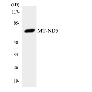 MT-ND5 Antibody - Western blot analysis of the lysates from Jurkat cells using MT-ND5 antibody.