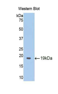 MT-ND5 Antibody - Western blot of recombinant MT-ND5.  This image was taken for the unconjugated form of this product. Other forms have not been tested.