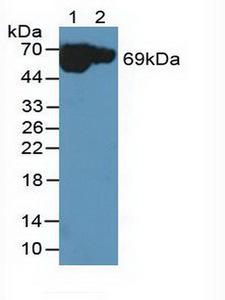 MT-ND5 Antibody - Western Blot; Sample: Lane1: Rat Serum; Lane2: Rat Heart Tissue.