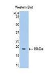 MT-ND5 Antibody - Western blot of recombinant MT-ND5.  This image was taken for the unconjugated form of this product. Other forms have not been tested.