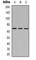 MT-ND5 Antibody - Western blot analysis of MT-ND5 expression in K562 (A); HeLa (B); mouse kidney (C) whole cell lysates.