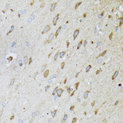 MT-ND5 Antibody - Immunohistochemistry of paraffin-embedded rat brain tissue.