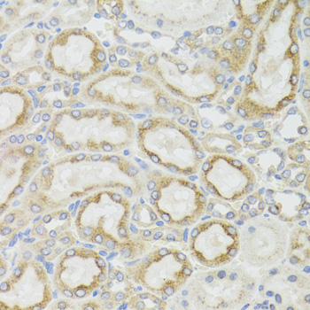 MT-ND5 Antibody - Immunohistochemistry of paraffin-embedded rat kidney tissue.