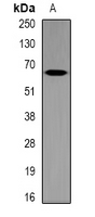 MT-ND5 Antibody - Western blot analysis of MT-ND5 expression in mouse brain (A) whole cell lysates.