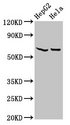 MT-ND5 Antibody - Positive Western Blot detected in HepG2 whole cell lysate, Hela whole cell lysate. All lanes: MT-ND5 antibody at 4.6 µg/ml Secondary Goat polyclonal to rabbit IgG at 1/50000 dilution. Predicted band size: 68 KDa. Observed band size: 68 KDa