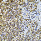 MT-ND5 Antibody - Immunohistochemistry of paraffin-embedded human tonsil using ND5 antibody at dilution of 1:100 (40x lens).