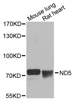 MT-ND5 Antibody - Western blot analysis of extracts of various cell lines, using ND5 antibody at 1:1000 dilution. The secondary antibody used was an HRP Goat Anti-Rabbit IgG (H+L) at 1:10000 dilution. Lysates were loaded 25ug per lane and 3% nonfat dry milk in TBST was used for blocking. An ECL Kit was used for detection and the exposure time was 10s.
