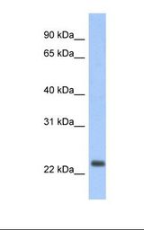 MT-ND6 Antibody - Fetal lung lysate. Antibody concentration: 1.0 ug/ml. Gel concentration: 12%.  This image was taken for the unconjugated form of this product. Other forms have not been tested.