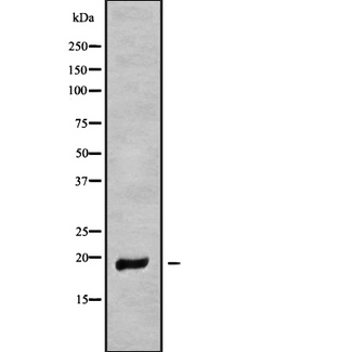 MT-ND6 Antibody - Western blot analysis of MT-ND6 using HepG2 whole cells lysates