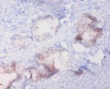 MT1A / Metallothionein 1A Antibody - Immunohistochemistry of paraffin-embedded human prostate at dilution of 1:20