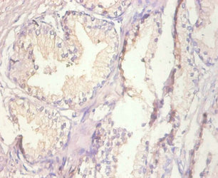 MT1A / Metallothionein 1A Antibody - Immunohistochemistry of paraffin-embedded human prostate tissue using MT1A Antibody at dilution of 1:20
