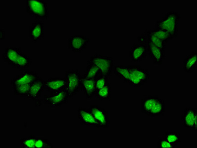 MT1E Antibody - Immunofluorescent analysis of HepG2 cells using MT1E Antibody at dilution of 1:100