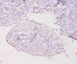 MT1E Antibody - Immunohistochemistry of paraffin-embedded human tonsil tissue using MT1E Antibody at dilution of 1:20