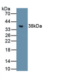 MT1E Antibody - Western Blot Sample: Recombinant MT1, Rat