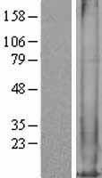 MT1M Protein - Western validation with an anti-DDK antibody * L: Control HEK293 lysate R: Over-expression lysate