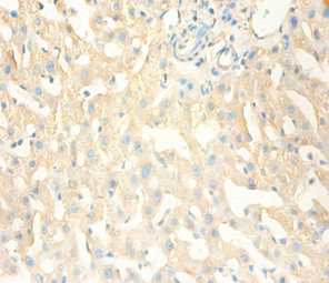 MT1X Antibody - Immunohistochemistry of paraffin-embedded human liver tissue using MT1X Antibody at dilution of 1:100