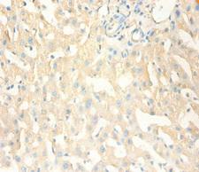 MT1X Antibody - Immunohistochemistry of paraffin-embedded human liver tissue using MT1X Antibody at dilution of 1:100