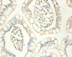 MT1X Antibody - Immunohistochemistry of paraffin-embedded human small intestine tissue using MT1X Antibody at dilution of 1:100