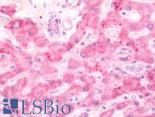 MT2A / Metallothionein 2A Antibody - Human Liver: Formalin-Fixed, Paraffin-Embedded (FFPE).  This image was taken for the unconjugated form of this product. Other forms have not been tested.